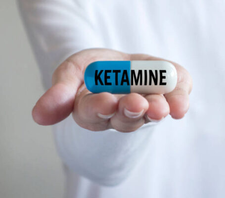Order Ketamine Tablet Near Me 2 Understanding Ketamine Tablet