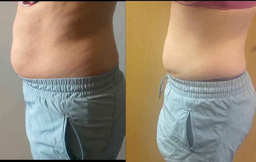 How to Lose 10 Pounds Fat 2 How To Lose 10 Pounds Fat